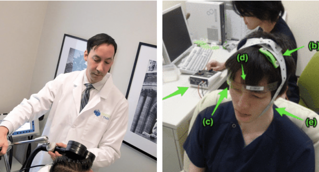 Knowing the Difference Between rTMS and tDCS - Mid City TMS