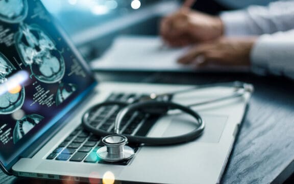theta burst stimulation side effects represented by a stethoscope on a computer keyboard, witht he computer showing