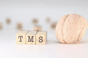 picture of a brain next to tms blocks detailing how many sessions for tms to work effectively